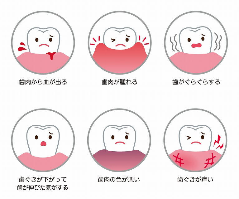 歯周病の治療